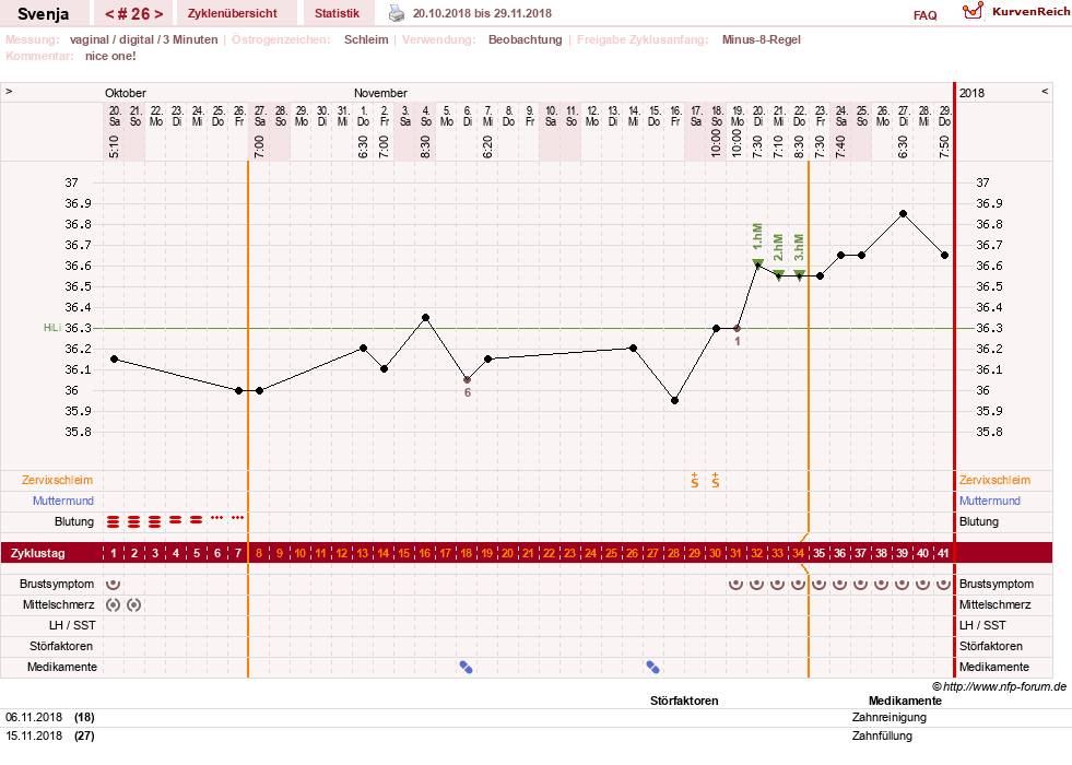NFP-Kurve User #26849