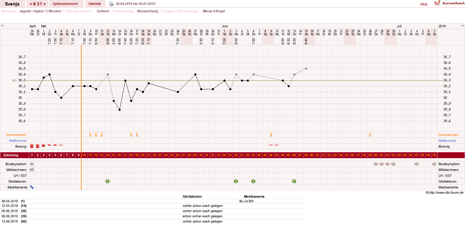 NFP-Kurve User #26849