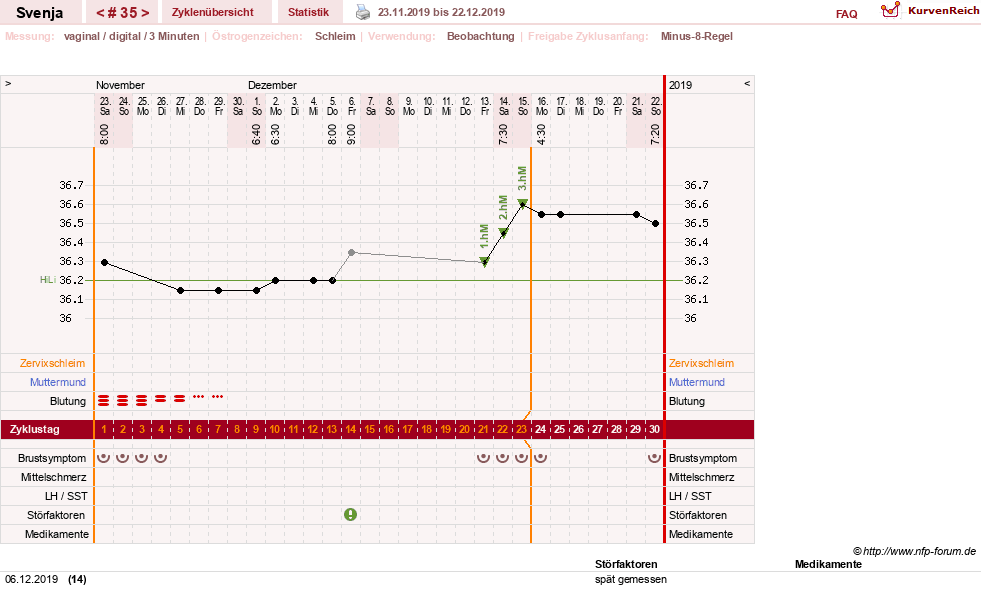 NFP-Kurve User #26849