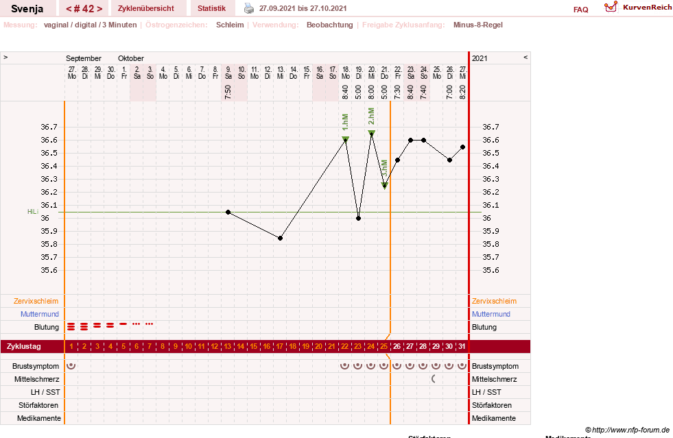 NFP-Kurve User #26849
