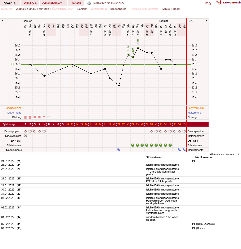 NFP-Kurve User #26849
