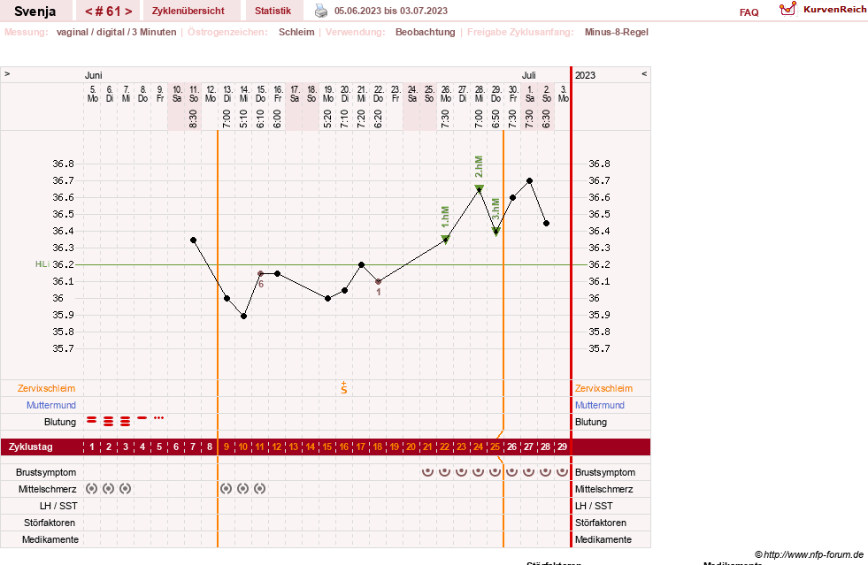 NFP-Kurve User #26849