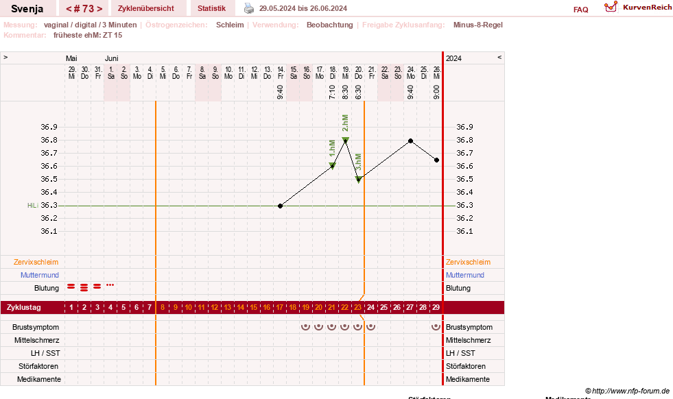 NFP-Kurve User #26849