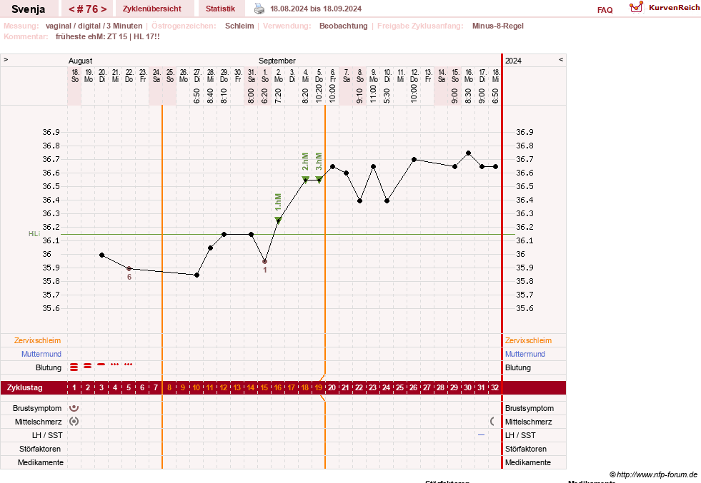 NFP-Kurve User #26849