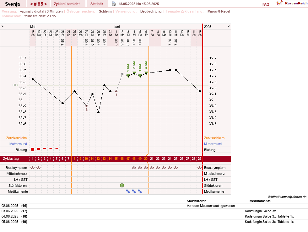 NFP-Kurve User #26849