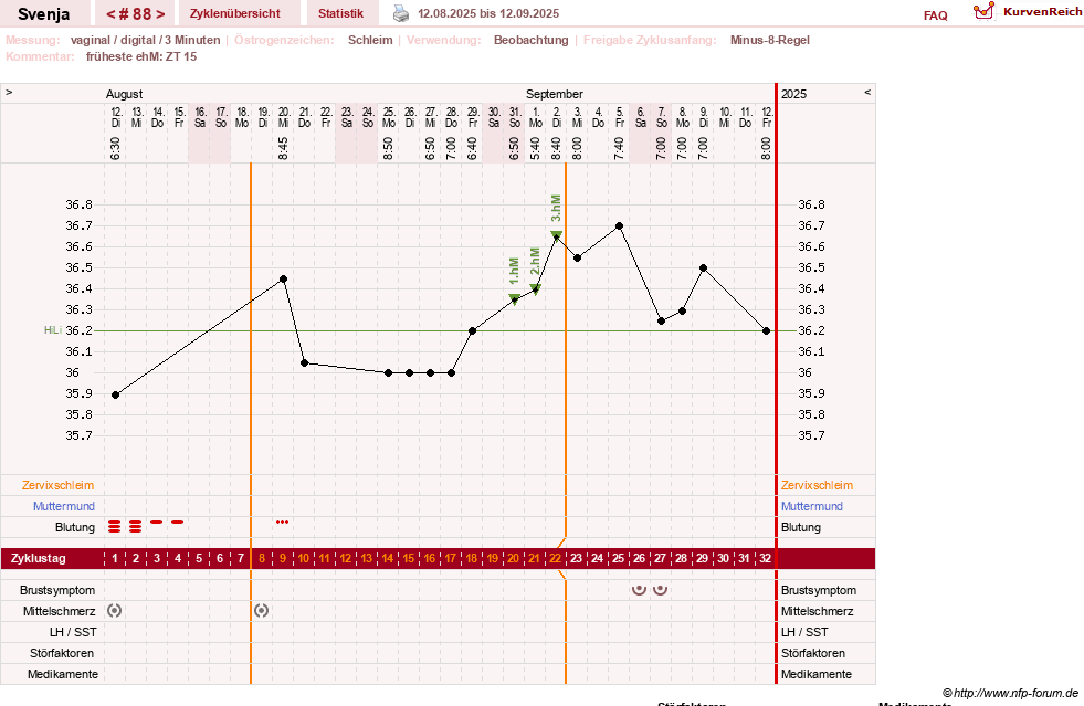 NFP-Kurve User #26849