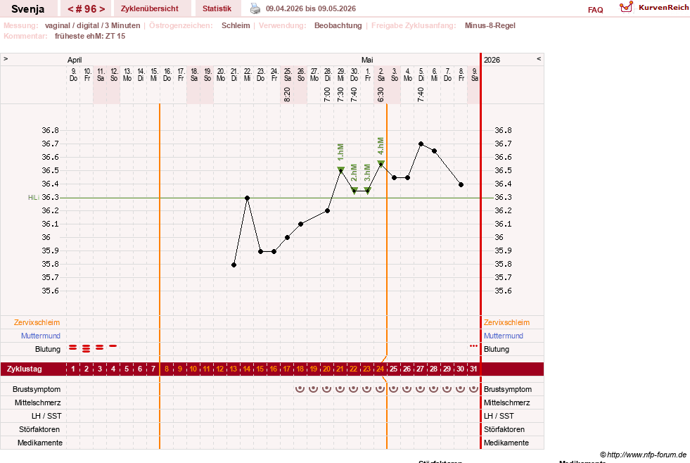 NFP-Kurve User #26849