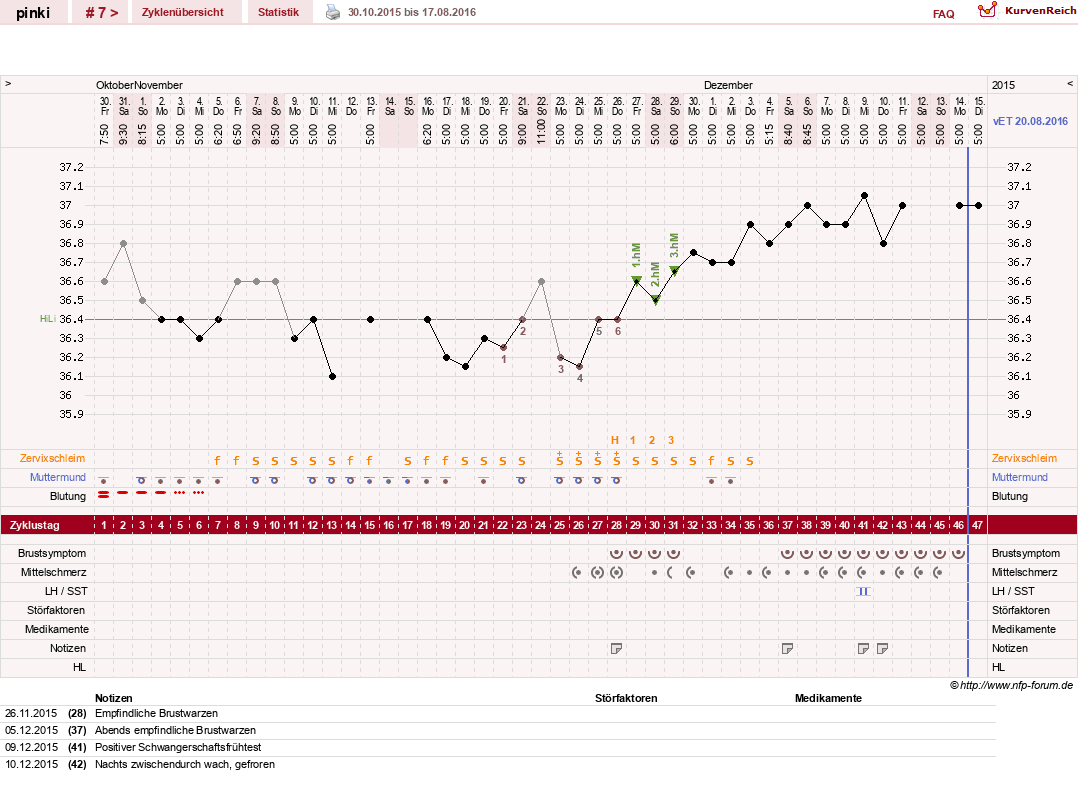 NFP-Kurve User #26863