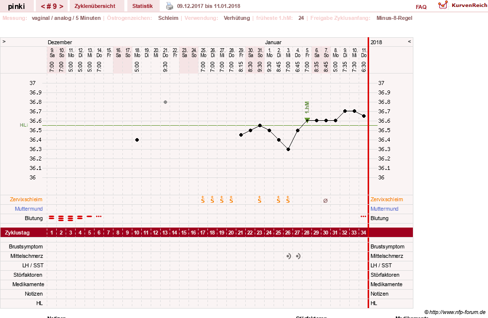 NFP-Kurve User #26863