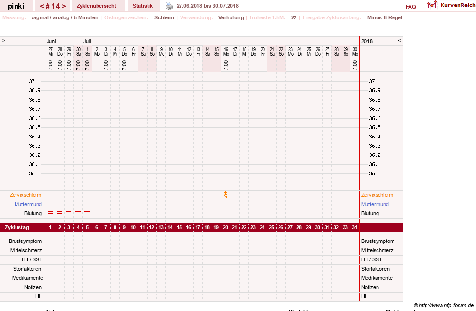 NFP-Kurve User #26863