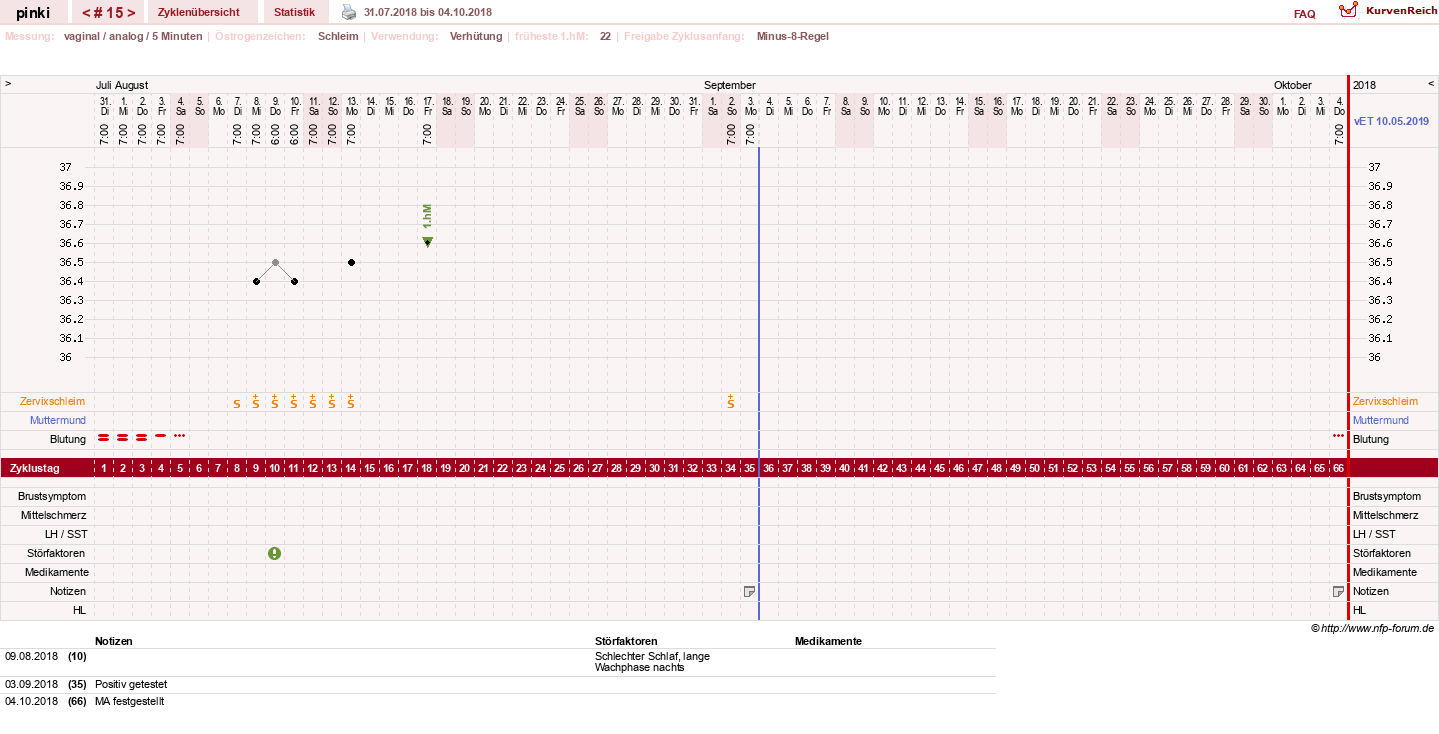 NFP-Kurve User #26863