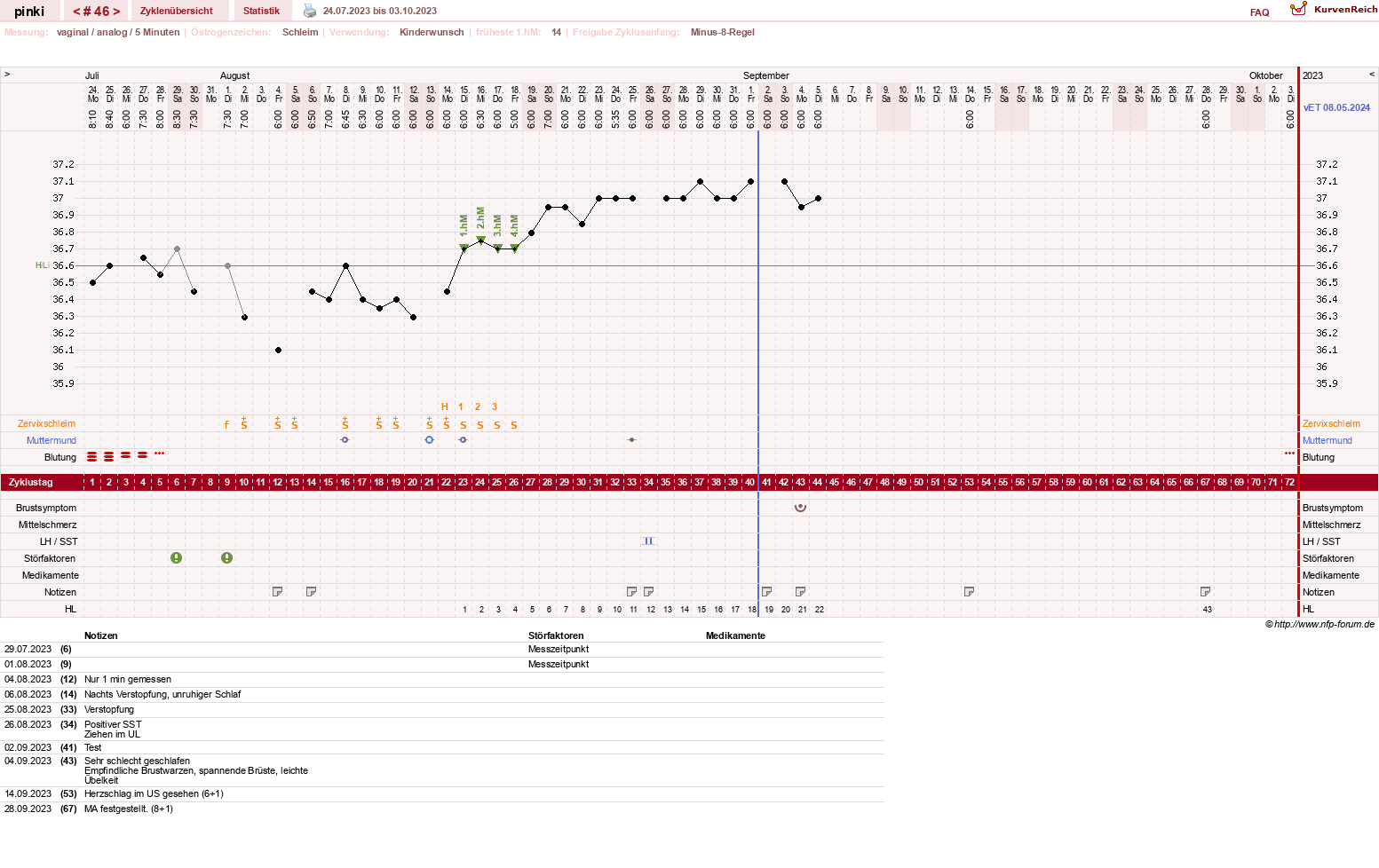NFP-Kurve User #26863