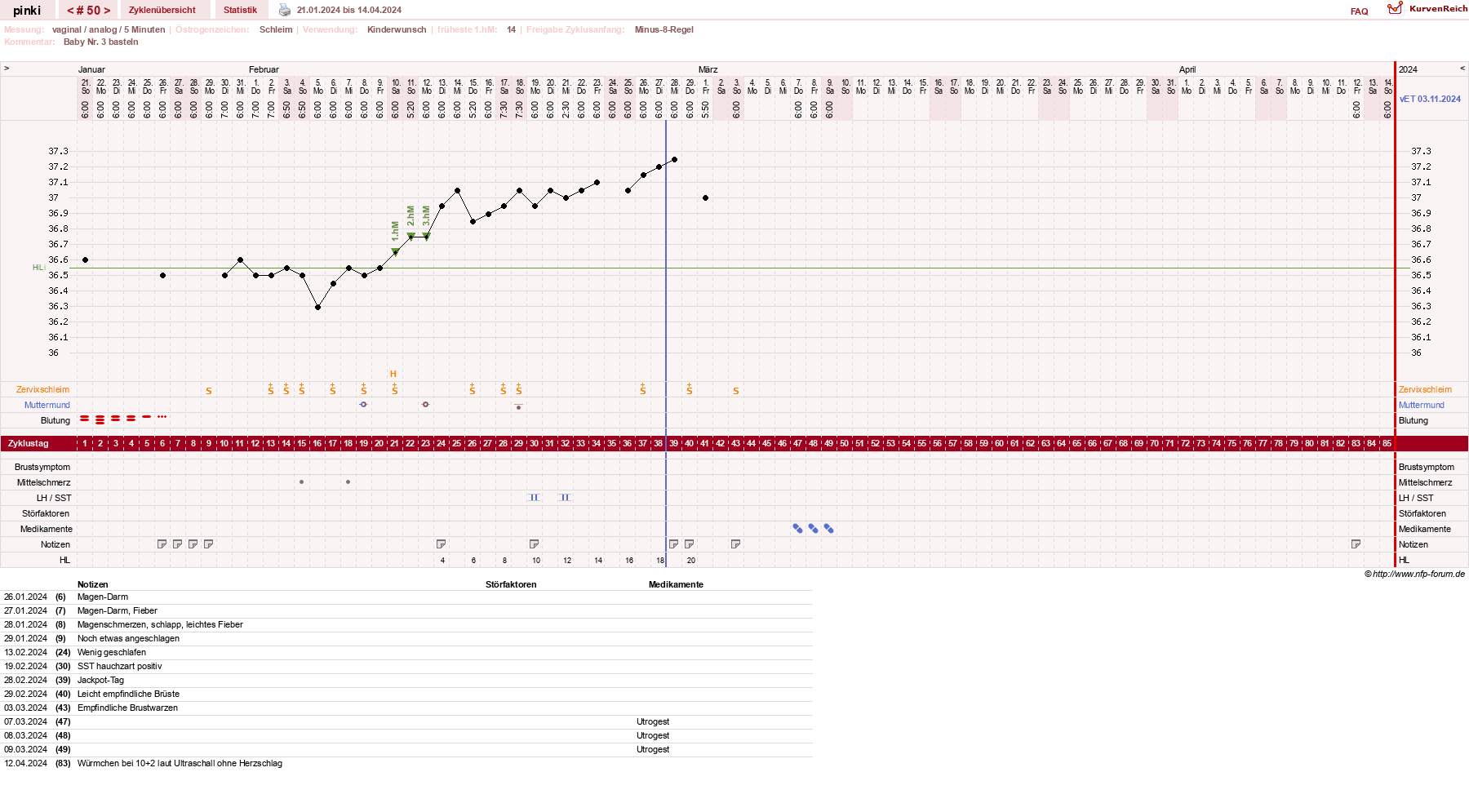 NFP-Kurve User #26863