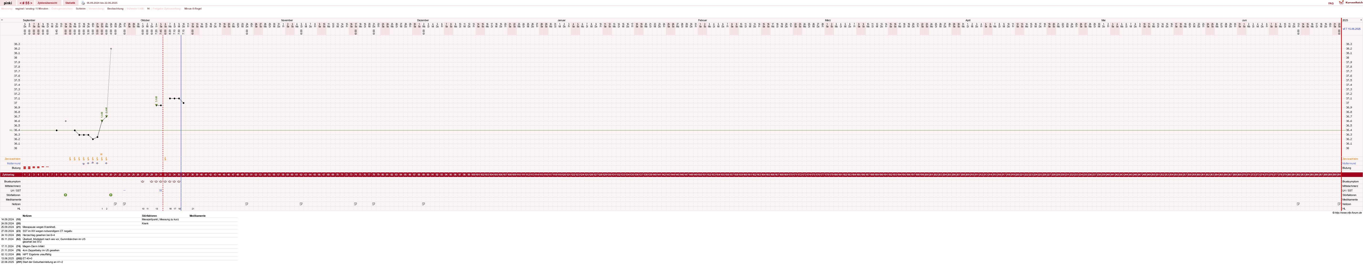 NFP-Kurve User #26863