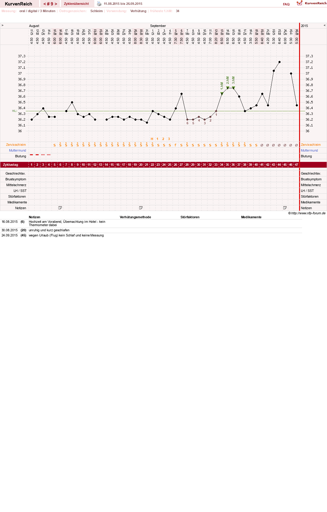 NFP-Kurve User #26889