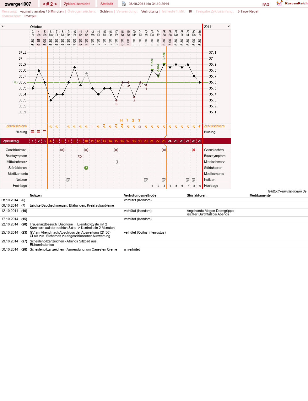 NFP-Kurve User #26895