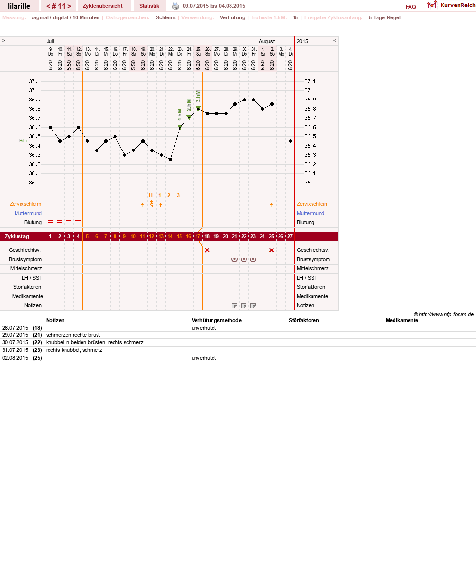 NFP-Kurve User #26913