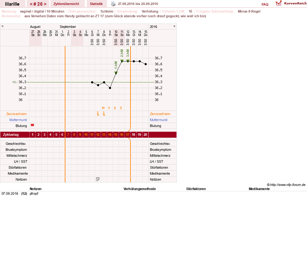 NFP-Kurve User #26913