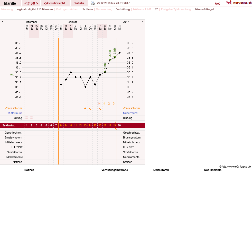 NFP-Kurve User #26913