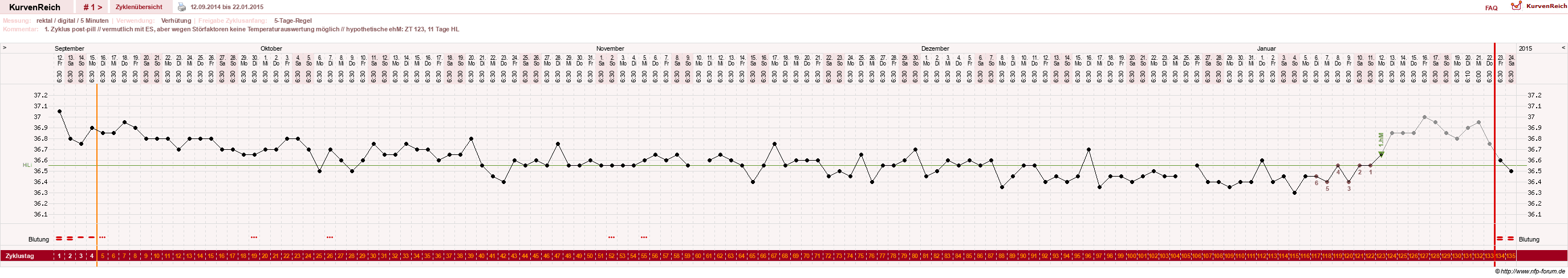 NFP-Kurve User #26919