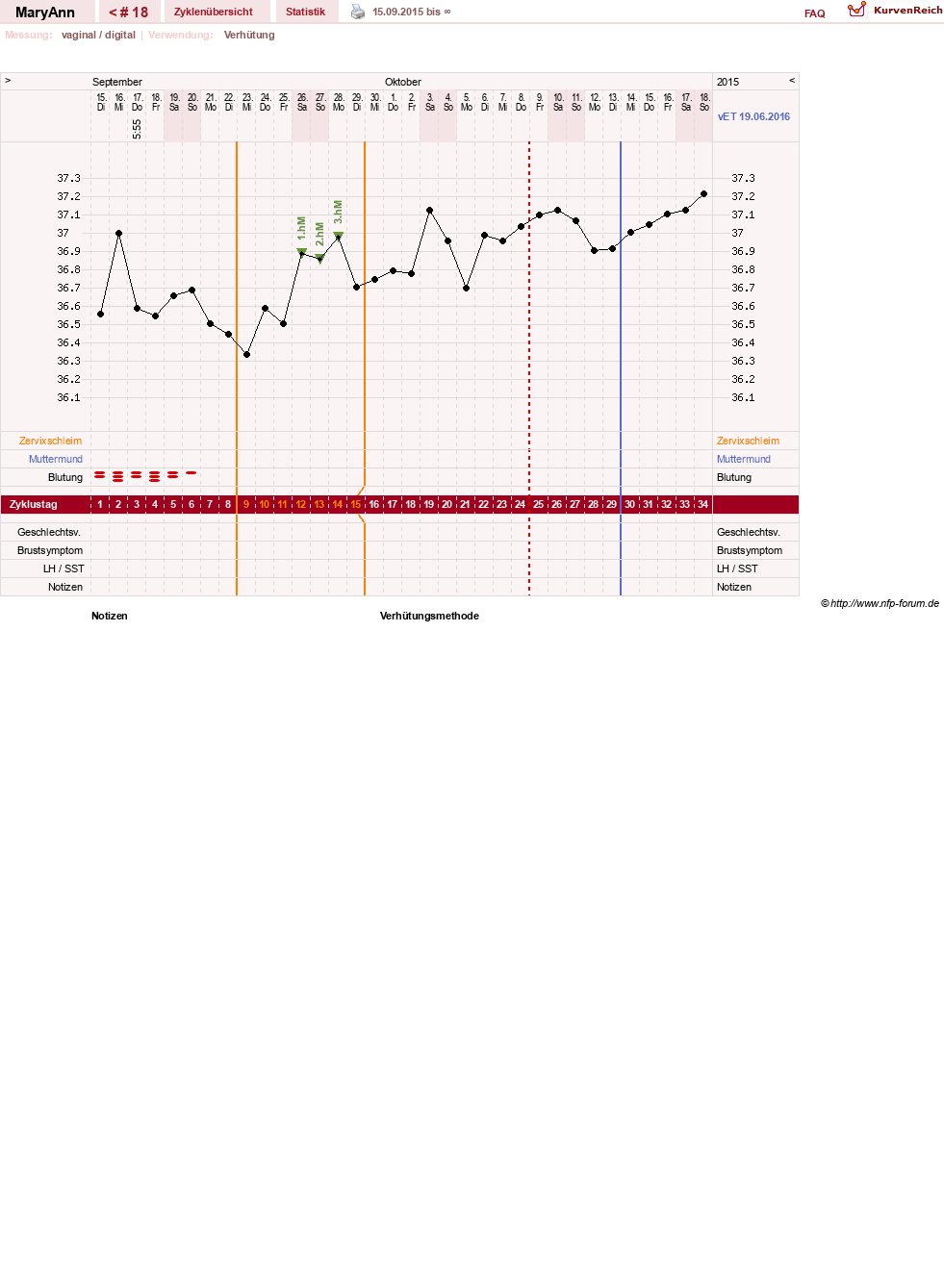 NFP-Kurve User #26933