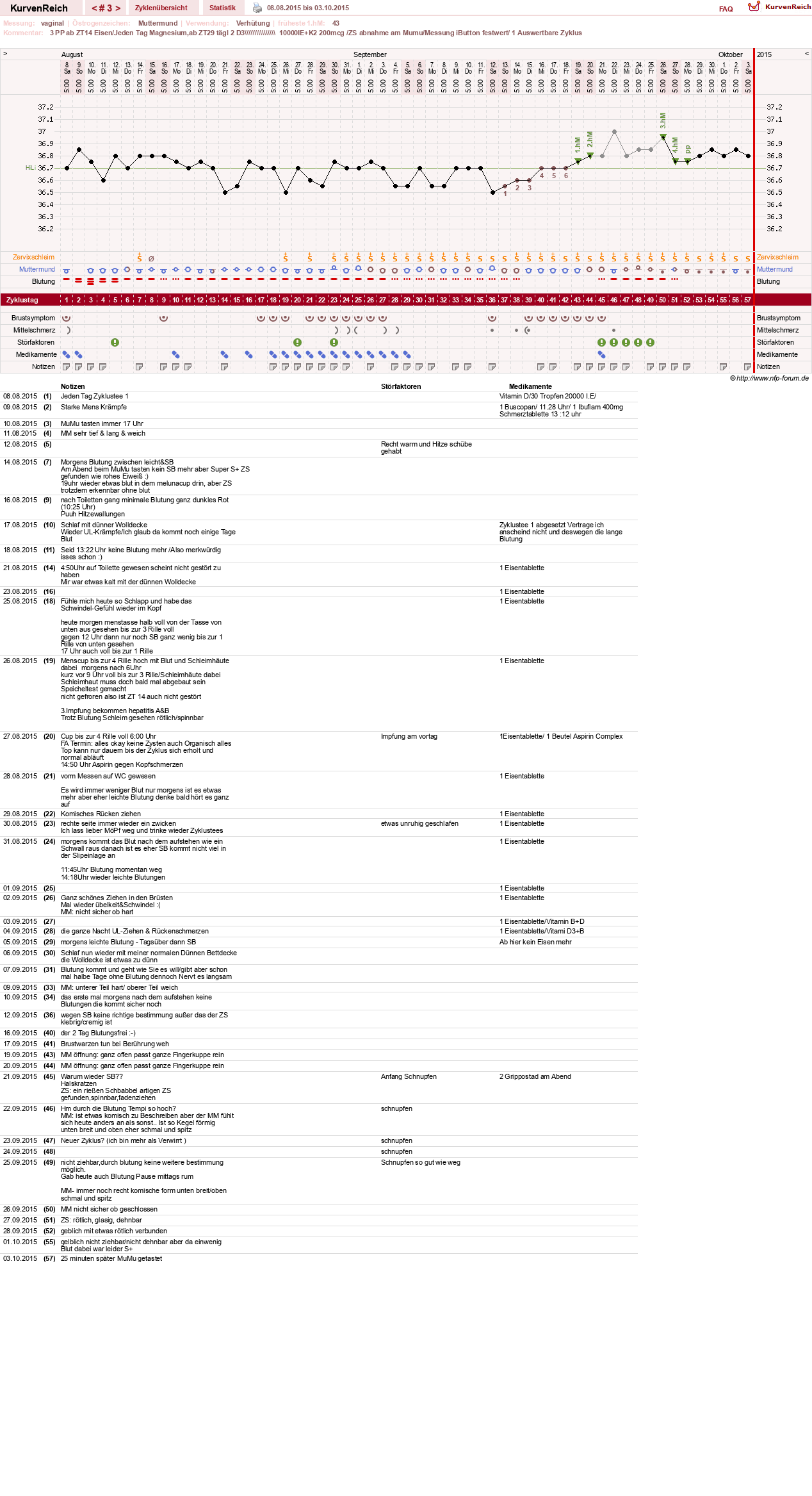NFP-Kurve User #27187