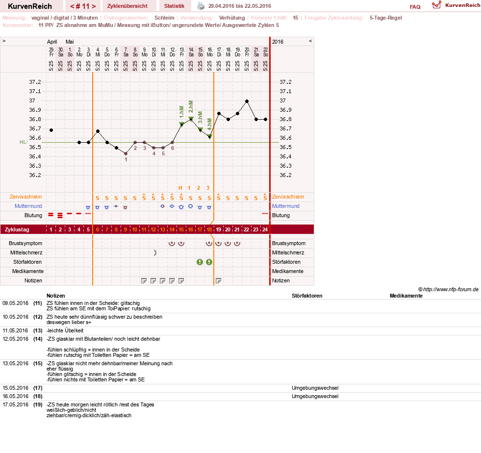 NFP-Kurve User #27187