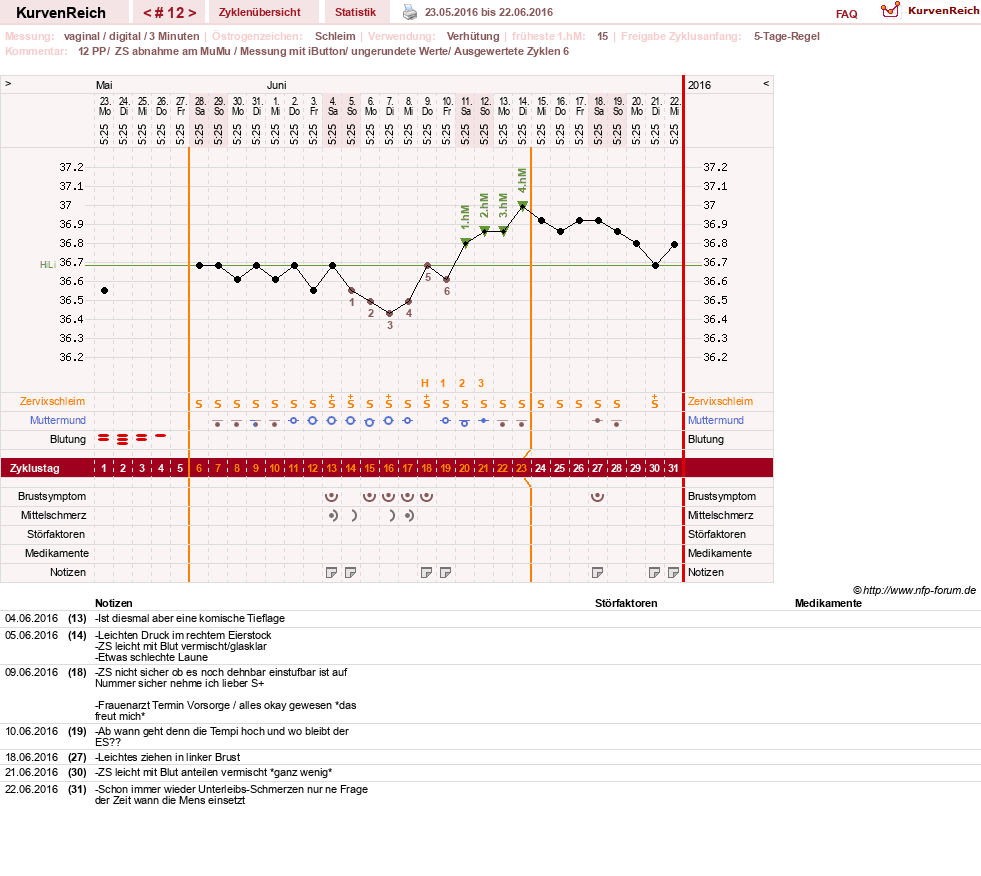 NFP-Kurve User #27187