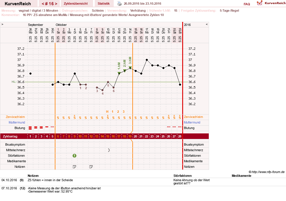 NFP-Kurve User #27187