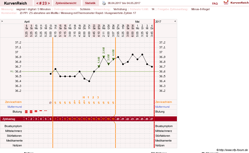 NFP-Kurve User #27187
