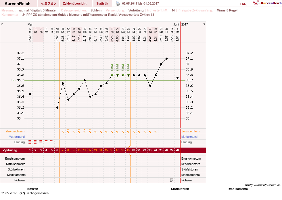 NFP-Kurve User #27187