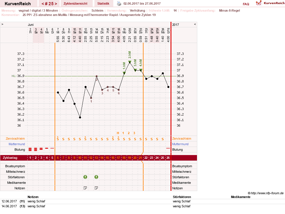 NFP-Kurve User #27187