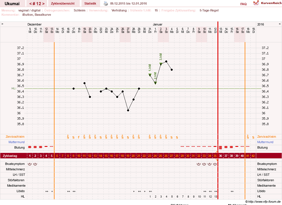 NFP-Kurve User #27204