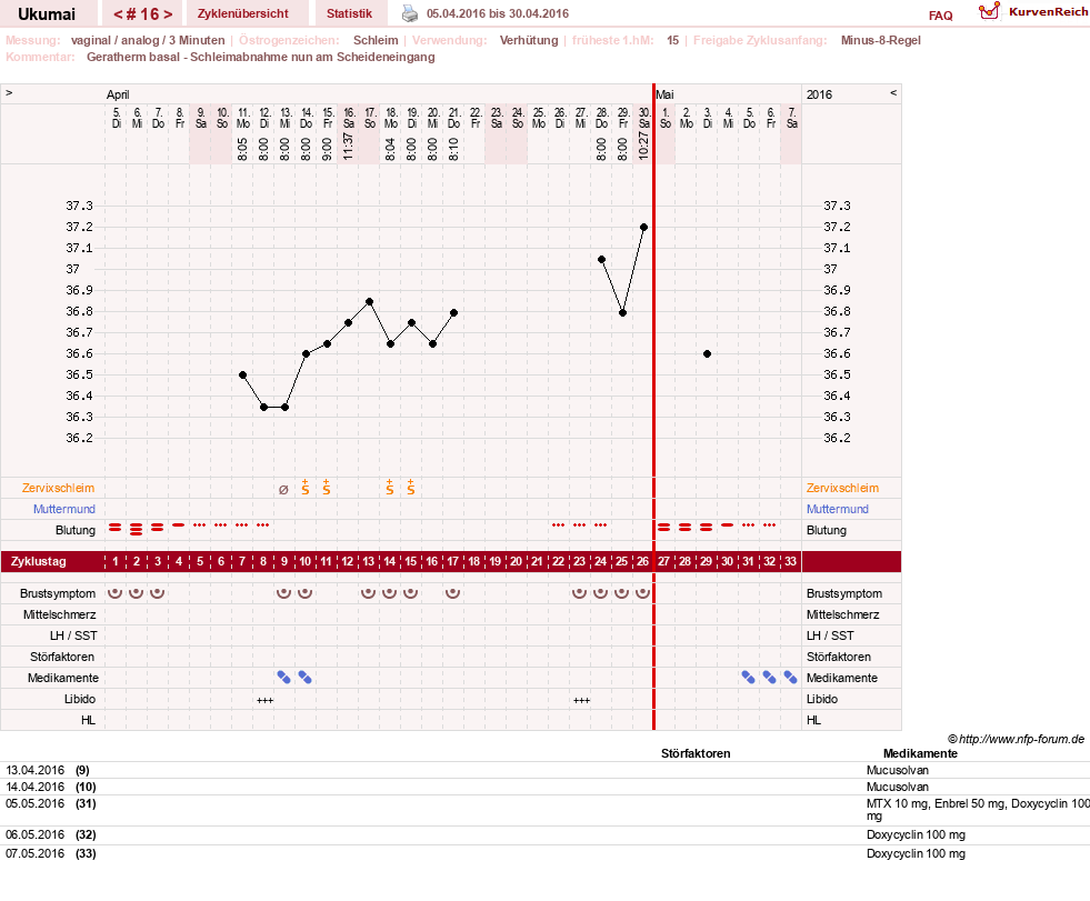 NFP-Kurve User #27204