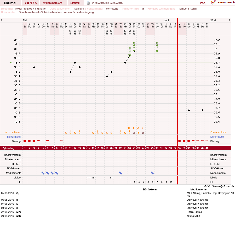 NFP-Kurve User #27204