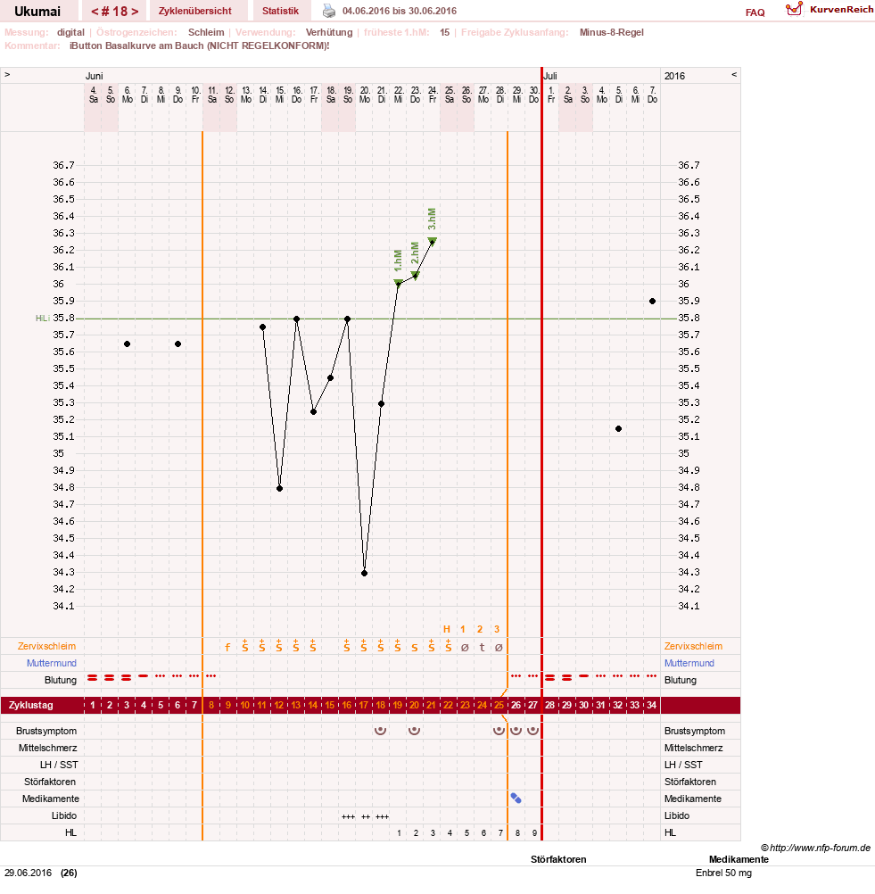 NFP-Kurve User #27204