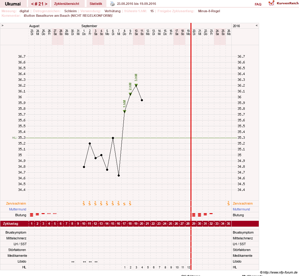 NFP-Kurve User #27204