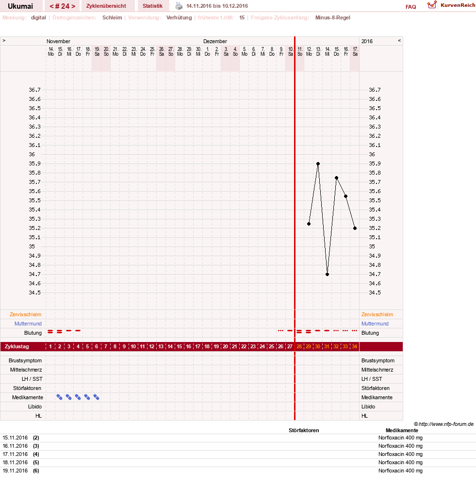 NFP-Kurve User #27204