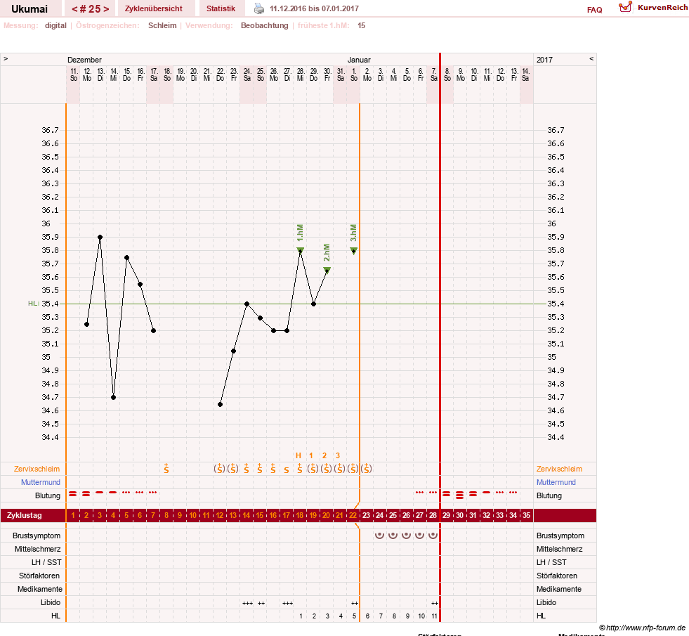 NFP-Kurve User #27204
