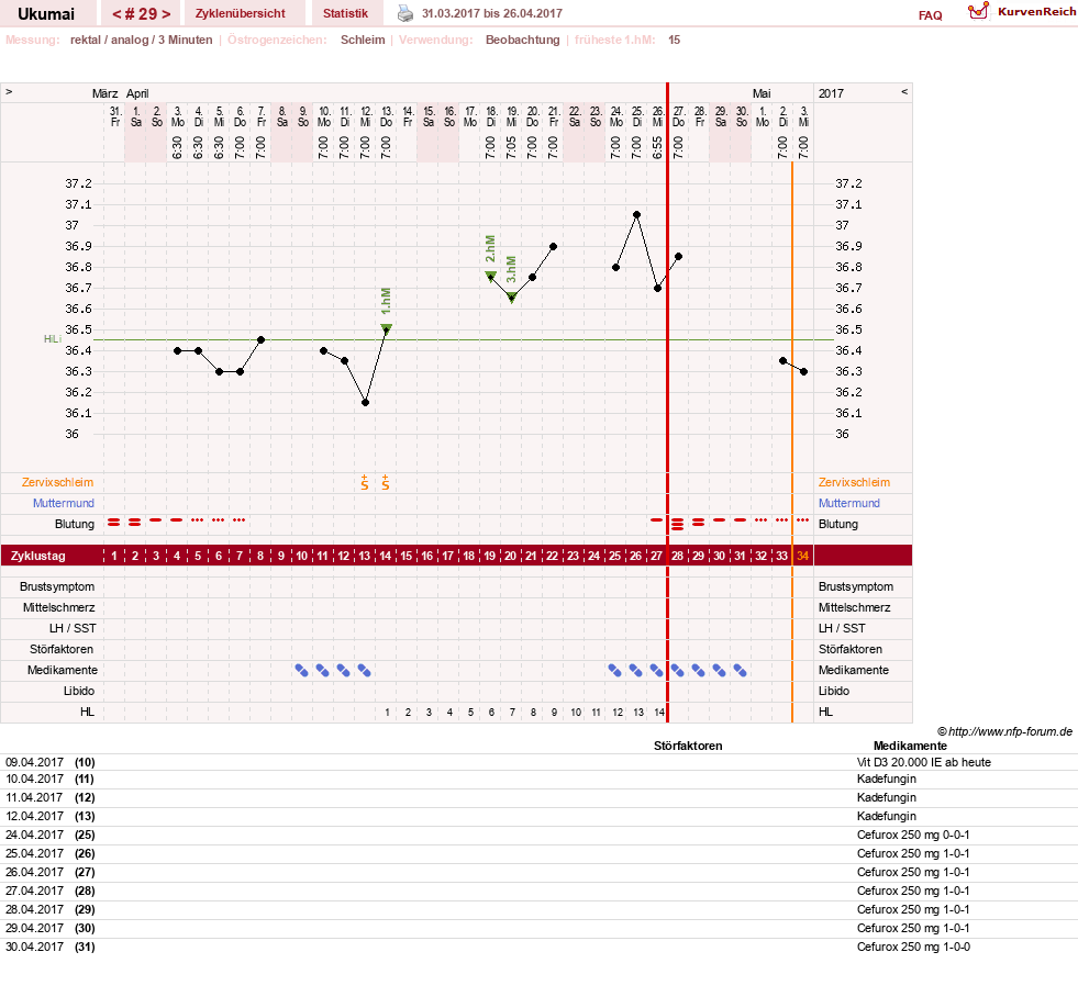 NFP-Kurve User #27204