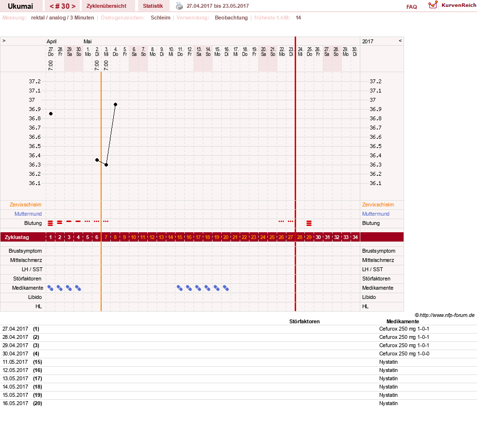 NFP-Kurve User #27204