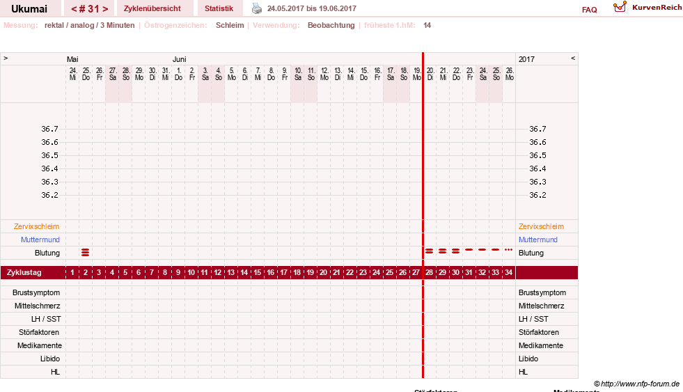 NFP-Kurve User #27204