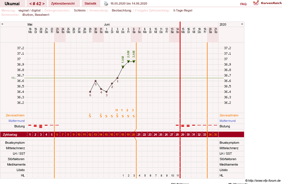 NFP-Kurve User #27204