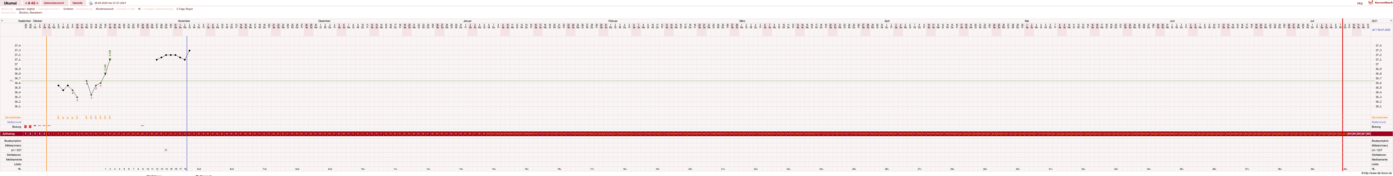 NFP-Kurve User #27204