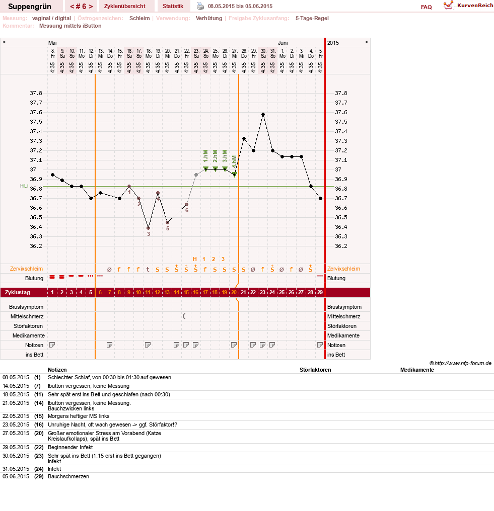 NFP-Kurve User #27255