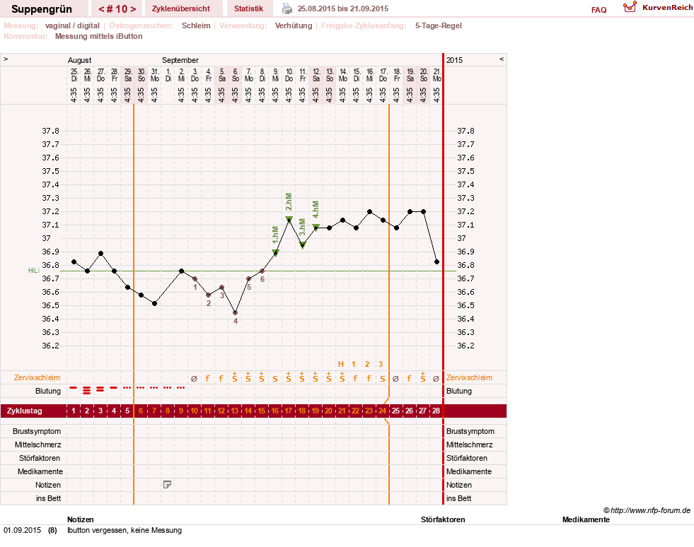 NFP-Kurve User #27255