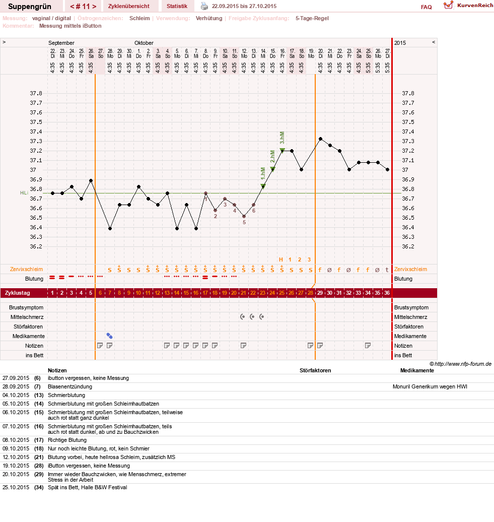 NFP-Kurve User #27255
