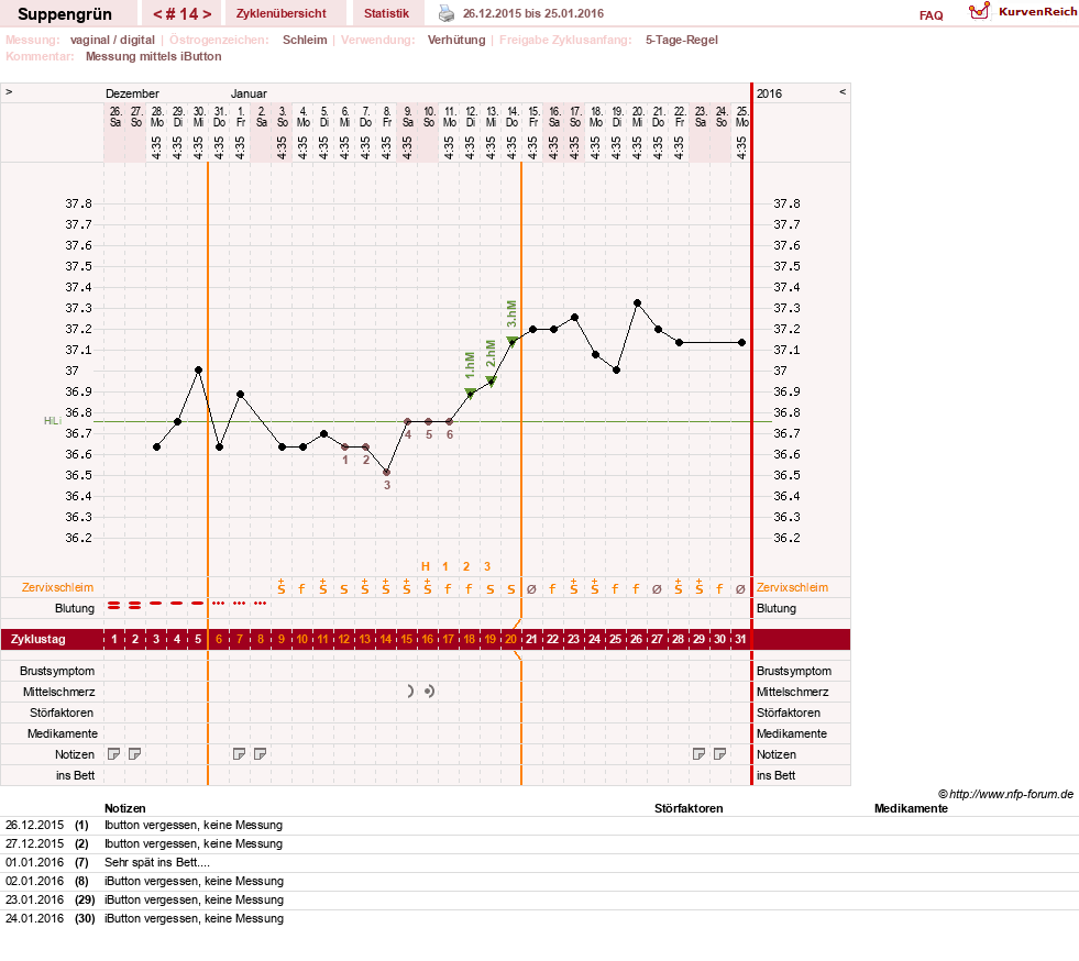 NFP-Kurve User #27255
