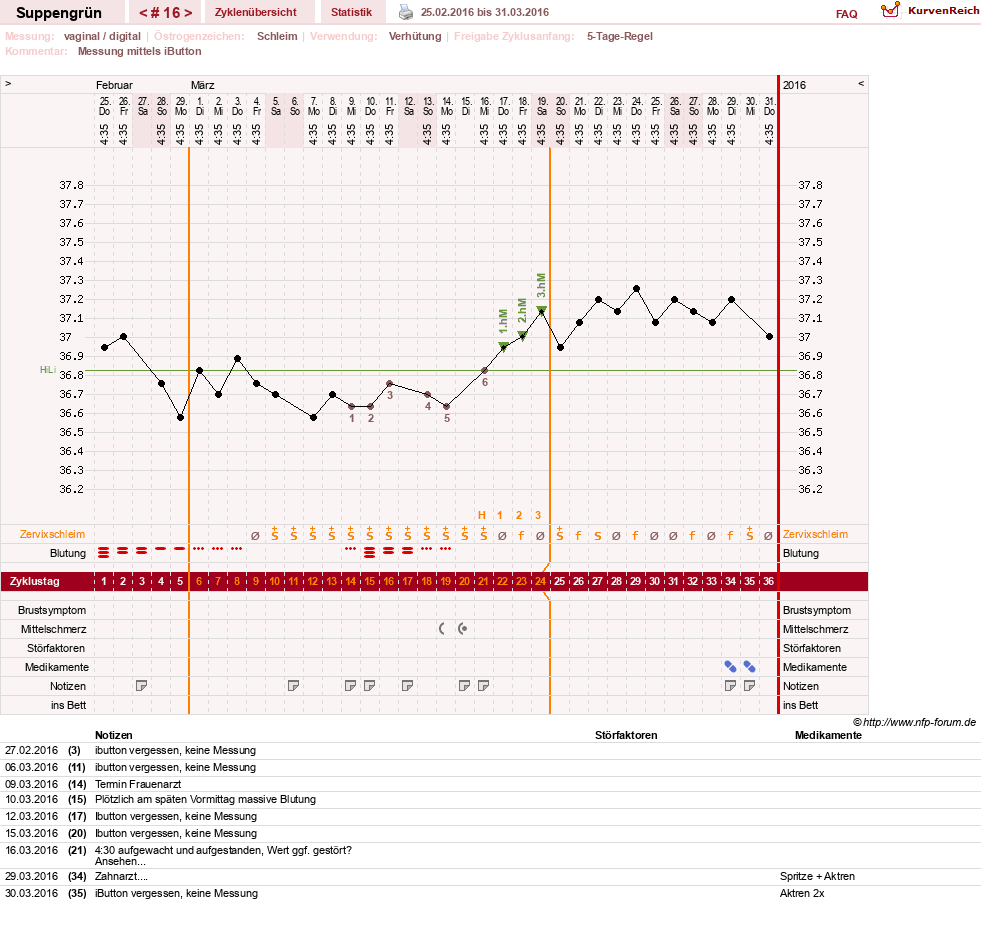 NFP-Kurve User #27255