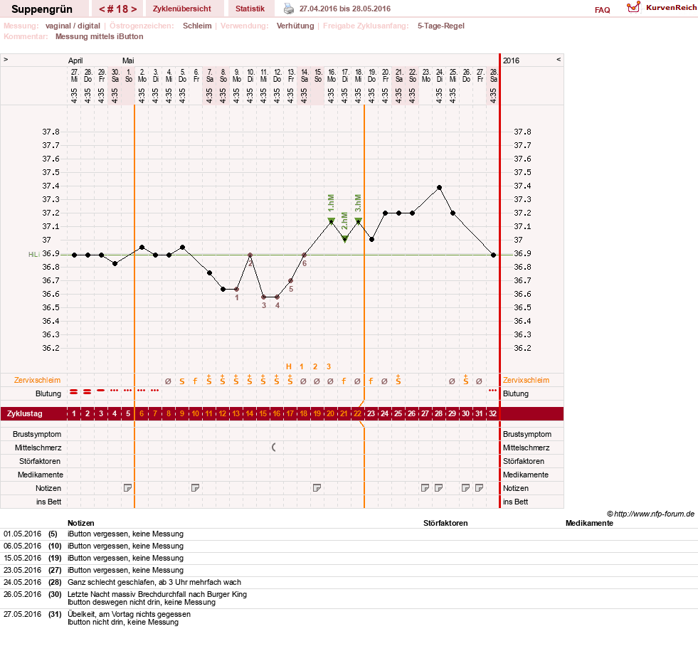 NFP-Kurve User #27255